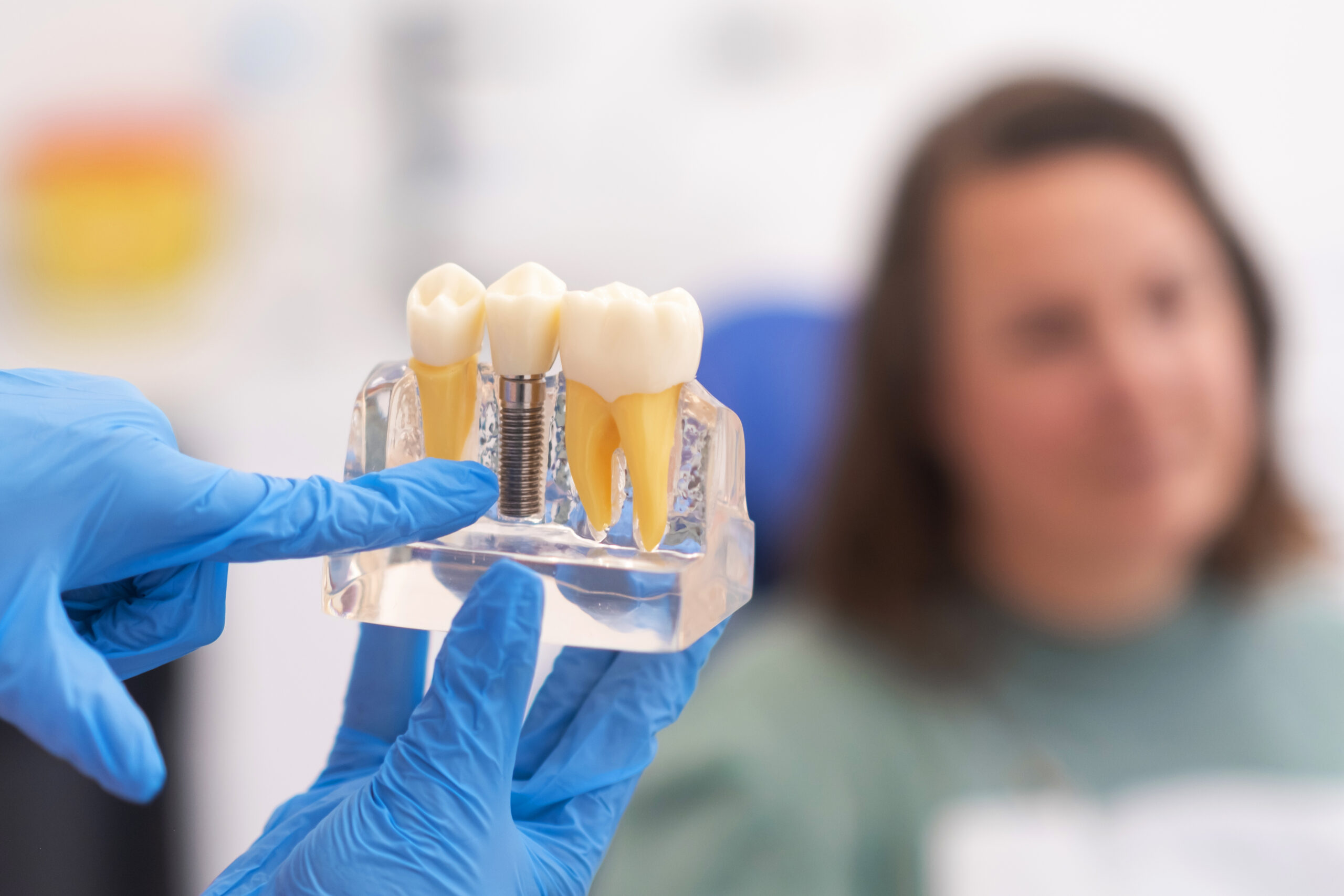 dental implants dentist discussing a treatment plan with patient holds a dental implant model